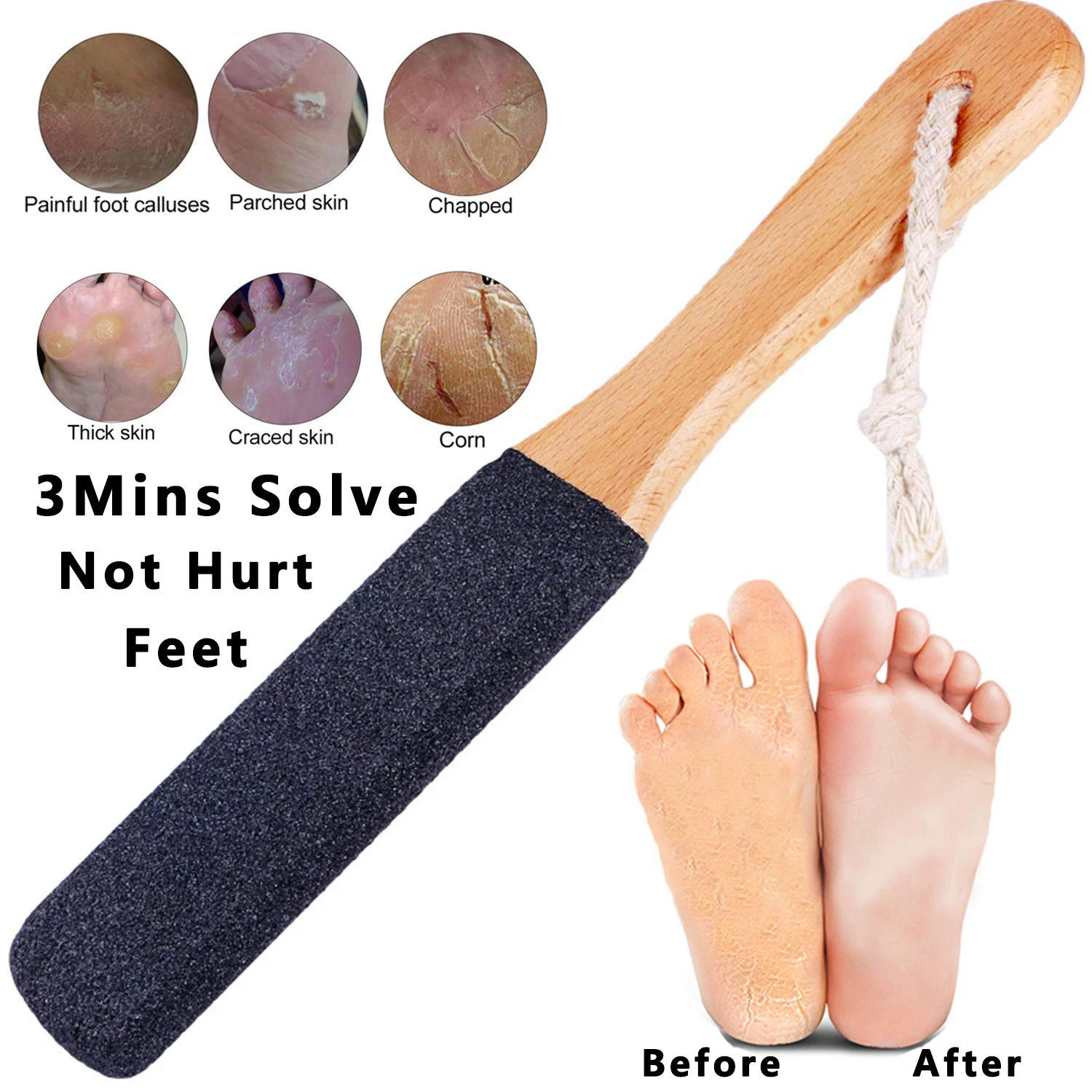 

Foot File Callus Remover Foot Scrubber,Professional Pedicure Foot Rasp Removes Cracked Heels,Dead Skin,Corn,Hard Skin,Pumice Sto