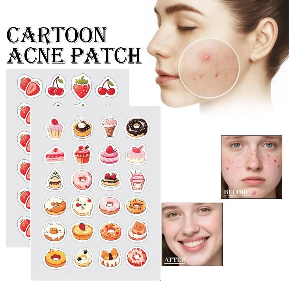 24pcs Cartoon Acne Patch Adorable Fruit & Dessert Prints Gentle Healing Infused With Essential Oils Cute Acne Concealing Safe