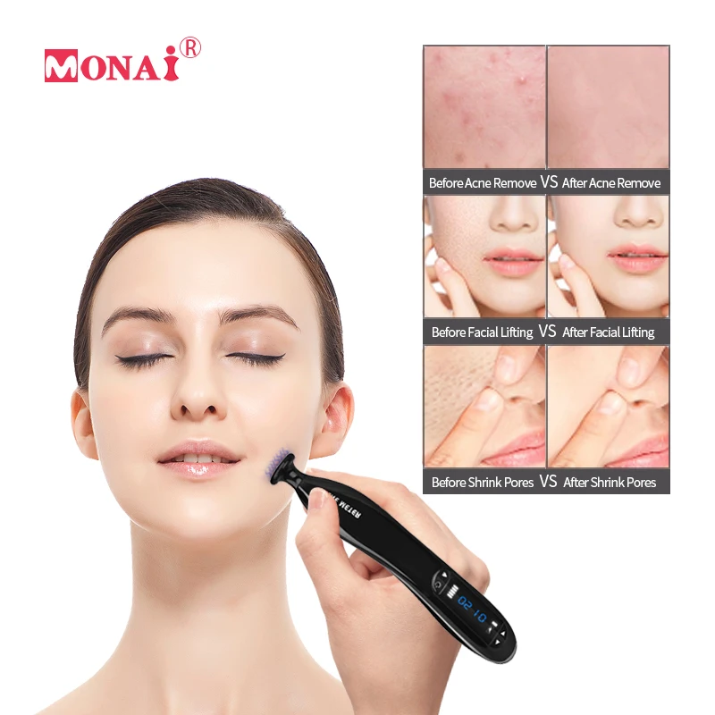 

Acne Removal Instrument Plasma Pen Dermatitis Remover Scar Pimple Remover Tool Face Cleaner Skin Care Anti Wrinkle Beauty Device