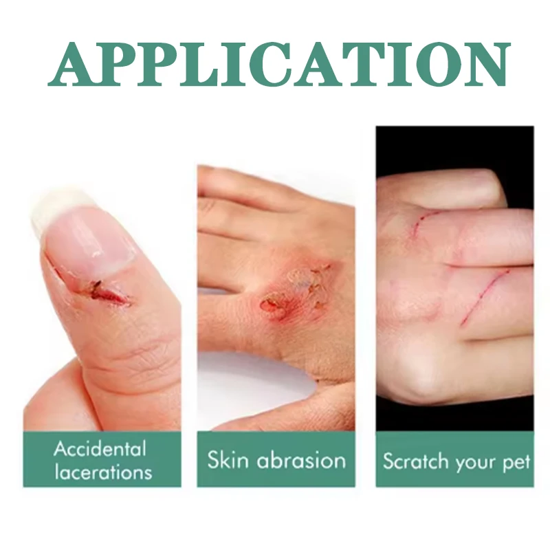 Official Genuine Nail Hemostatic Agent Quickly to Stop Bleeding Sterilize Water for Manicure image 2
