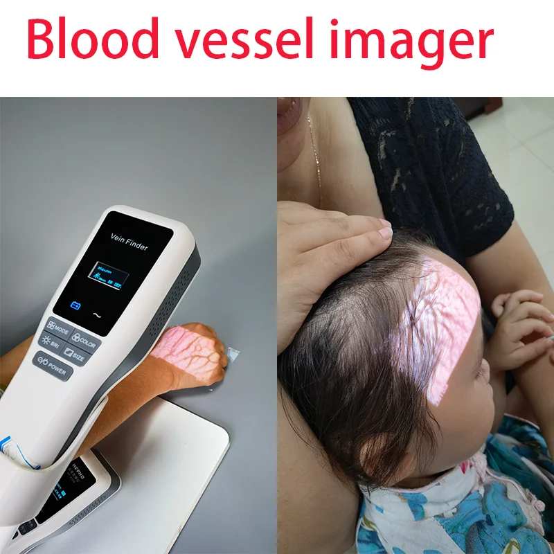 Vein Finder Locator Handheld Portable Near-Infrared Blood Vessel Display Nurse Intravenous Injection Aids Medical Device