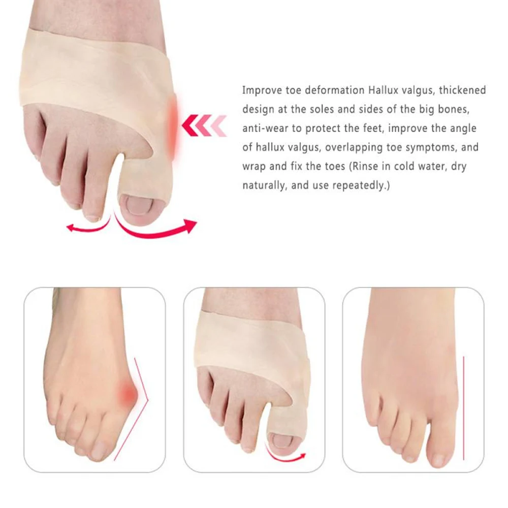 Tcare 1Pair New Gel Orthopedic Bunion Corrector Sleeves - Foot Bunion Protector- Hallux Valgus Original Big Toe Bunion Corrector