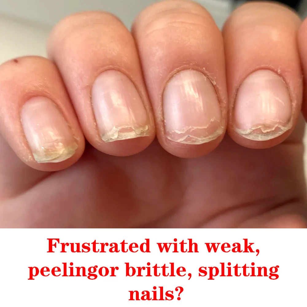 KODIES GEL Quick Dry Nail Strengthener 3 Day Nail Growth Polish Hardener Bright Oil for Repair Thin Soft Nails Care Serum 20ML