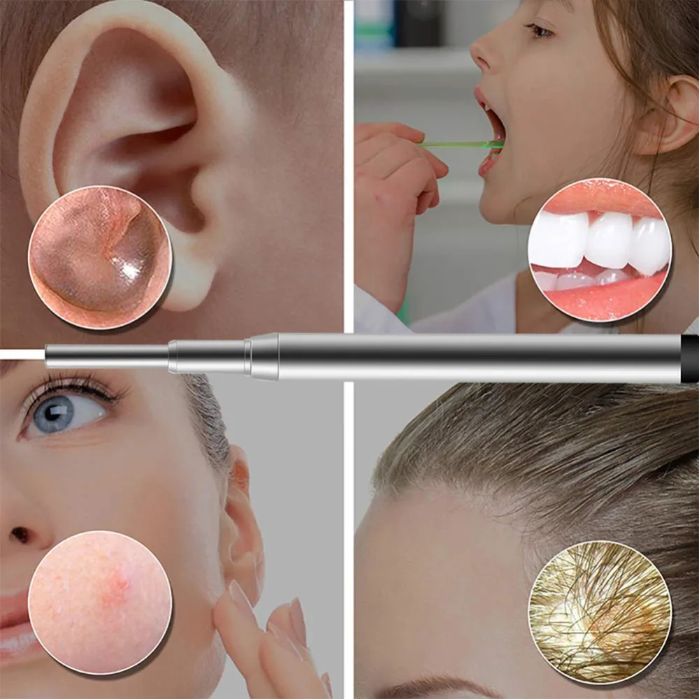 Caméra endoscopique sans fil, Wi-Fi, 2MP, 3.9mm, élimination des avertissements d'oreille, inspection kanoscope, nettoyeur d'oreille pour la vérification de la peau buccale