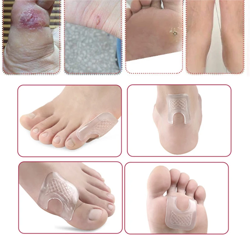 Pexmen 2/4 peças almofadas de dedo do pé à prova d'água em forma de u almofadas de calos de gel de fricção reutilizável adesivo de milho protetor de calos