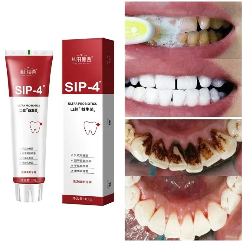 

100g SP-4 Oralshark Probiotic Whitening Shark Toothpaste Teeth Whitening Toothpaste Oral Care Fresh Breath Prevents Plaque