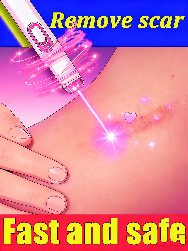 

The secret to skin rebirth! Gentle laser scar repair