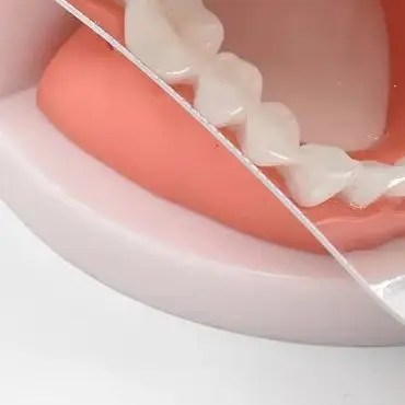 

Clear Imaging Anti Fog Intraoral Mirror Dental Tools For Orthodontics Defog Mirror Buccal Occlusal Lingual Use High Quality