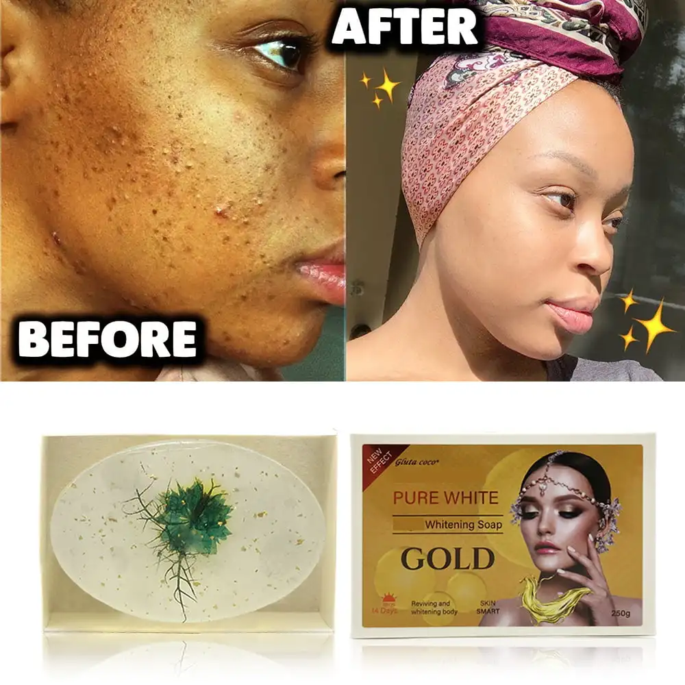 [2025.04 Baru! ] Sabun Pemutih G5D ANTI Jerawat/Penuaan/Kerut/Noda/Strech Mark