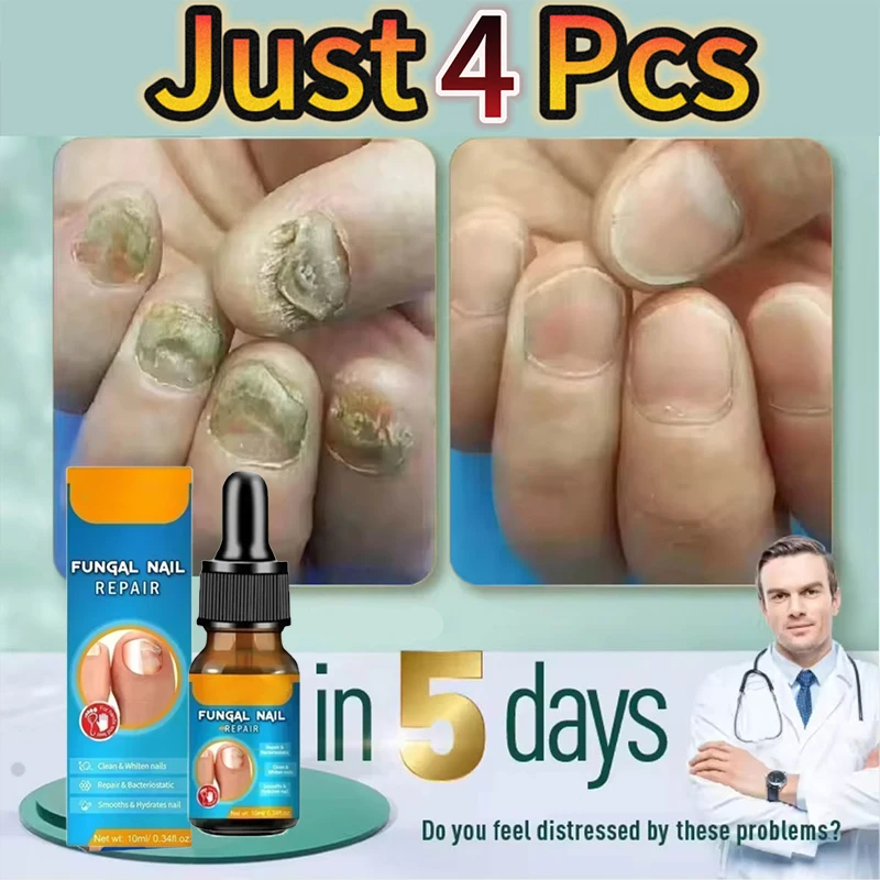 7-day nail care solution that effectively removes onychomycosis and beautifies fingernails and toenails