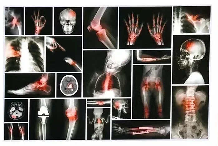 2025/2026 آلة الأشعة السينية الرقمية المختبرية باليد البشرية معدات الأشعة السينية DR الطبية المحمولة الأشعة السينية مع لوحة مسطحة رقمية Dete #4
