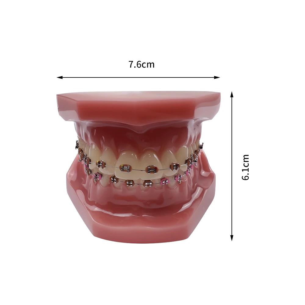 Dental Orthodontic Teeth Model With Metal Brackets Ligature Ties Ortho Treatment Typodont Dentist Tool For Patient Communication