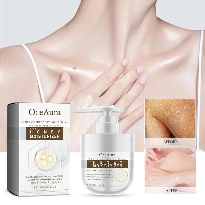 

Honey Body Moisturizer - Nourish Dry Skin, Improve Roughness, Boost Radiance & Lock Moisture With Honey & Beeswax