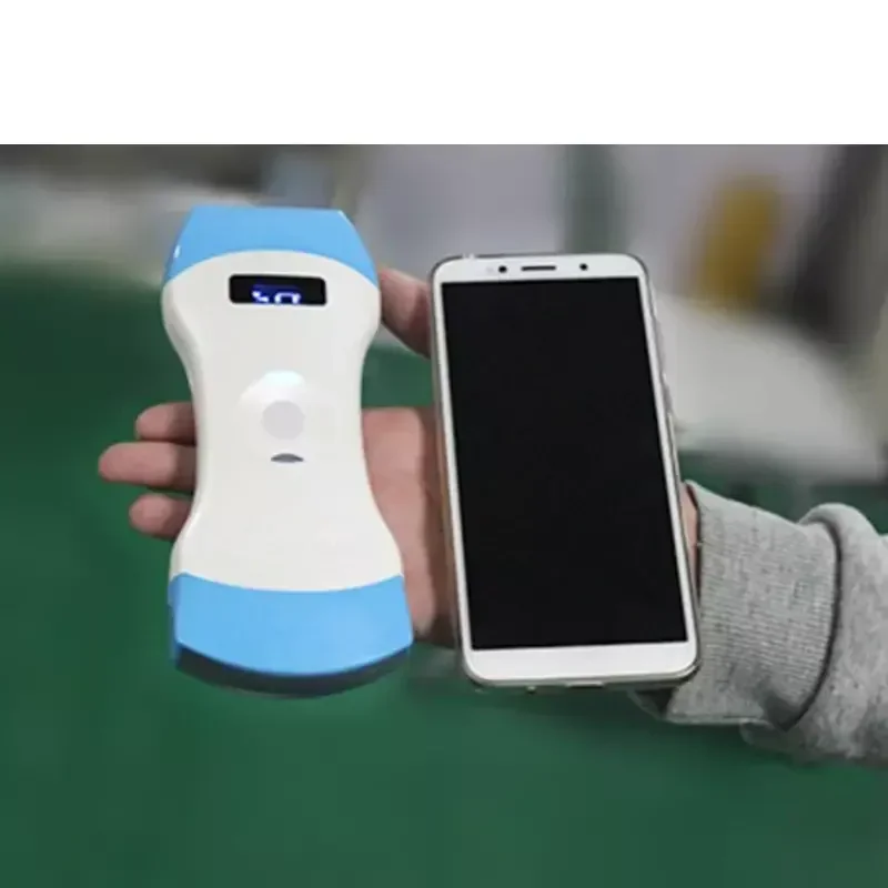 Hospital Medical Full Digital Wireless Probe Mobile Phone Portable Handheld Ultrasound Machine