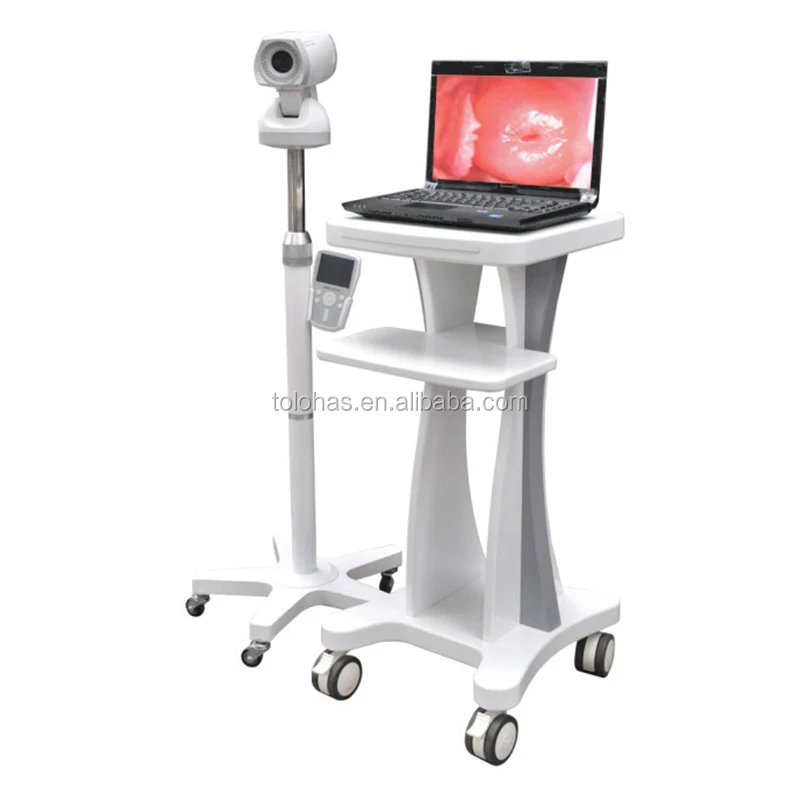 

LH9800A Digital Video Gynecological Colposcopy Endoscopes Wheeled Machine