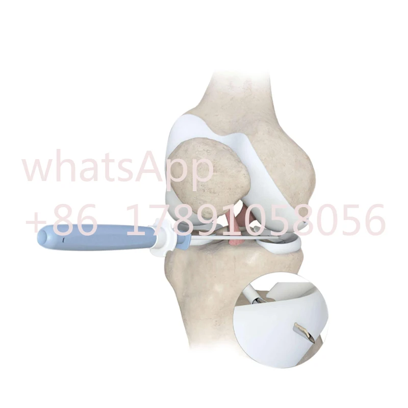 Orthopedic Fast Fix Meniscal Suture Meniscus Repair Arthroscopy System