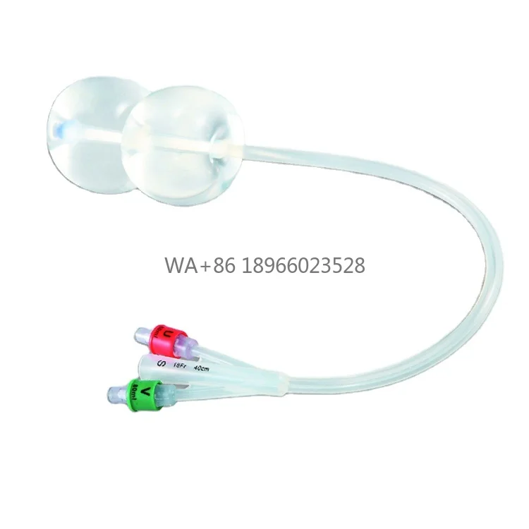 cateter-de-balon-desechable-para-dilatacion-y-maduracion-cervical