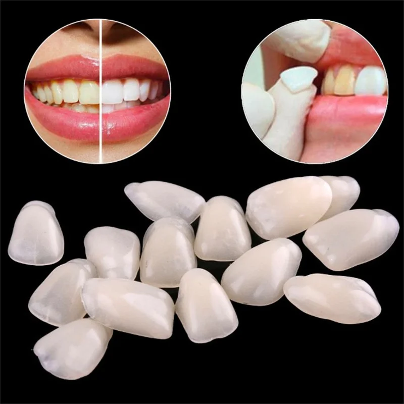 50pcs Dental Veneers Temporary Teeth Whitening Dental Membrane Teeth Whitening Veneer Resin Teeth On The Front Cover A