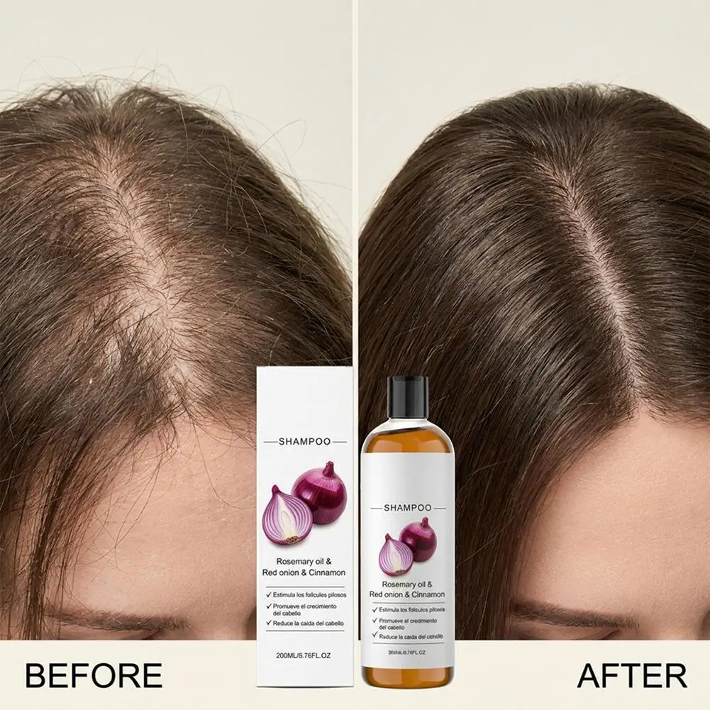 

Шампунь с розмарином и красным луком против выпадения волос, для укрепления и увеличения густоты, уход за волосами, 200 мл