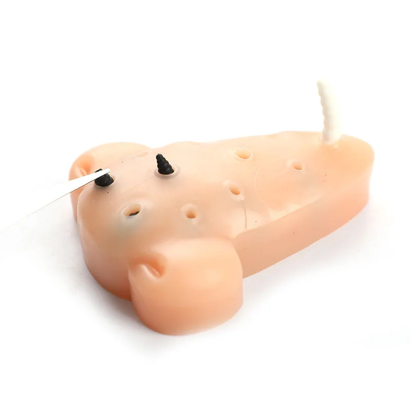 Blackhead Shape Pimple Toys Squeeze Acne Stress Relief Toys Remover Stop Toys