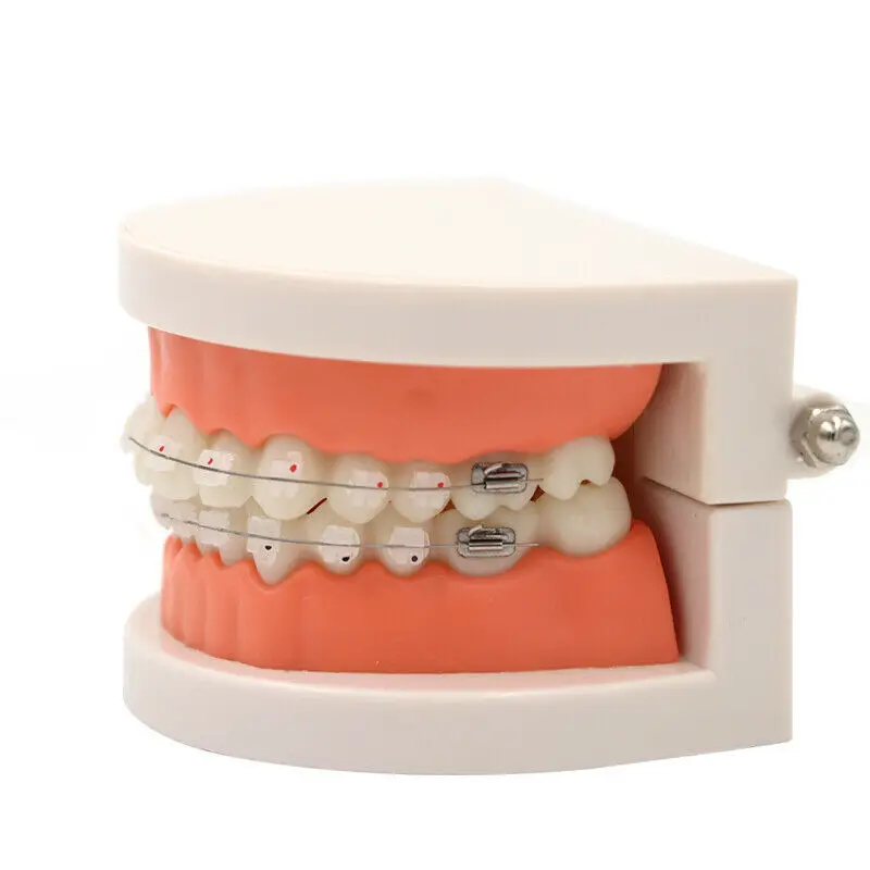 5pcs Dental Teaching Model Study Orthodontic Teeth Model With Ceramic Brackets Braces High-Quality Adult Typodont Model