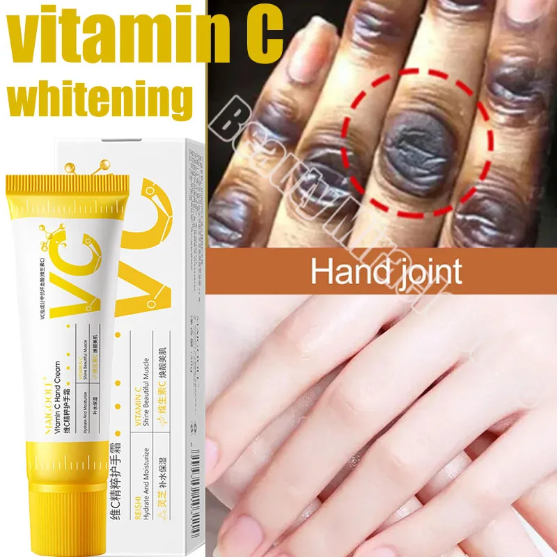 

Fast Whitening Dark Knuckles Brighten Hand Cream Melanin Corrector Moisturizing Intense Stains Remover Products Skin Care