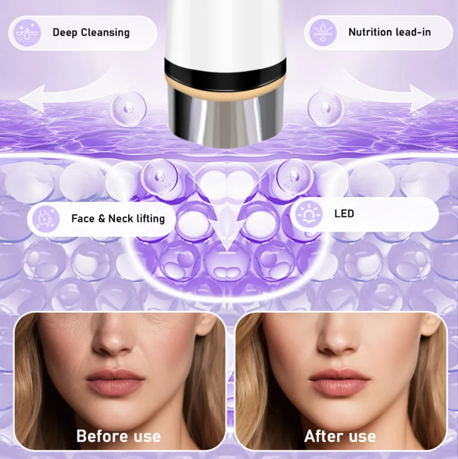 Thumbnail 2 - #2 Budget Eye Massage Instruments for Smart Shoppers