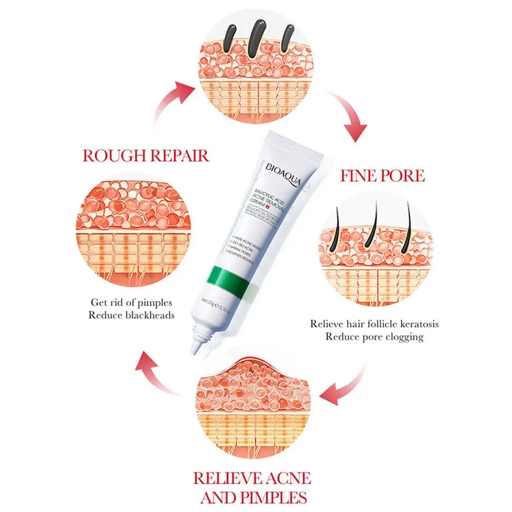 Salicylic Acid Acne Spot Treatment Cream Regulate Sebum Secretion Minimize Pores Calm Irritated Redness Remove Pimples Repair