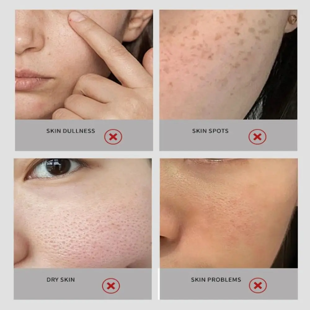 Tightening Skin Anti-freckle Essence Oil Age Spot Remover Reduce Fine Lines 577 Facial Spray Moisturizing Face Essence Oil