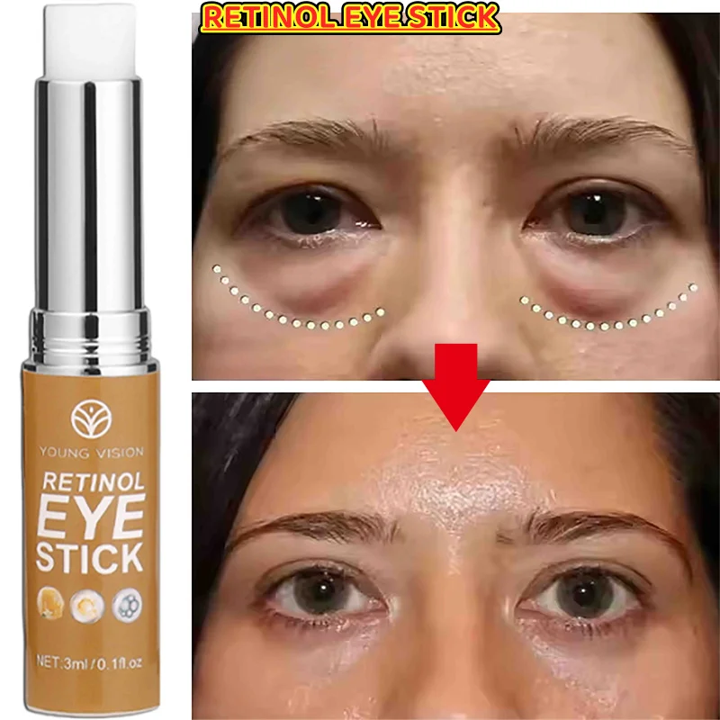 

Retinal Eye Creams Stick Dark Circles Removal Instant Powerful Anti Wrinkle Cream Eyes Skincare Korean Cosmetics Products Beauty
