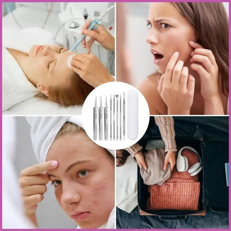 

8-Piece Extraction Tool Set In Stainless Steel Box, Professional For Spas And Beauty Salons (Includes Free 10pcs Pad)
