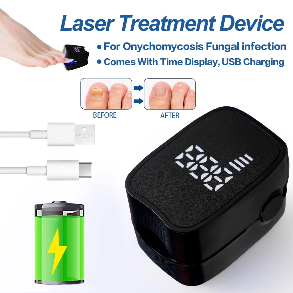 JUSTLANG Rechargeable Fungus Grey Nail Treatment Device Portable Onychomycosis Treatment Laser Therapy Relieve Ingrown Foot Care