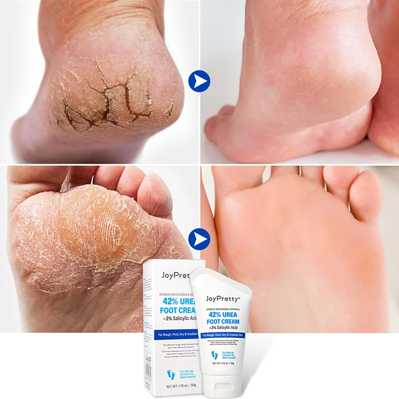 

Moisturizing Hand Feet Skin Care Foot Mask Anti-Drying Crack Exfoliator Removal Dead Skin Moisturizing Nourish Skin Care