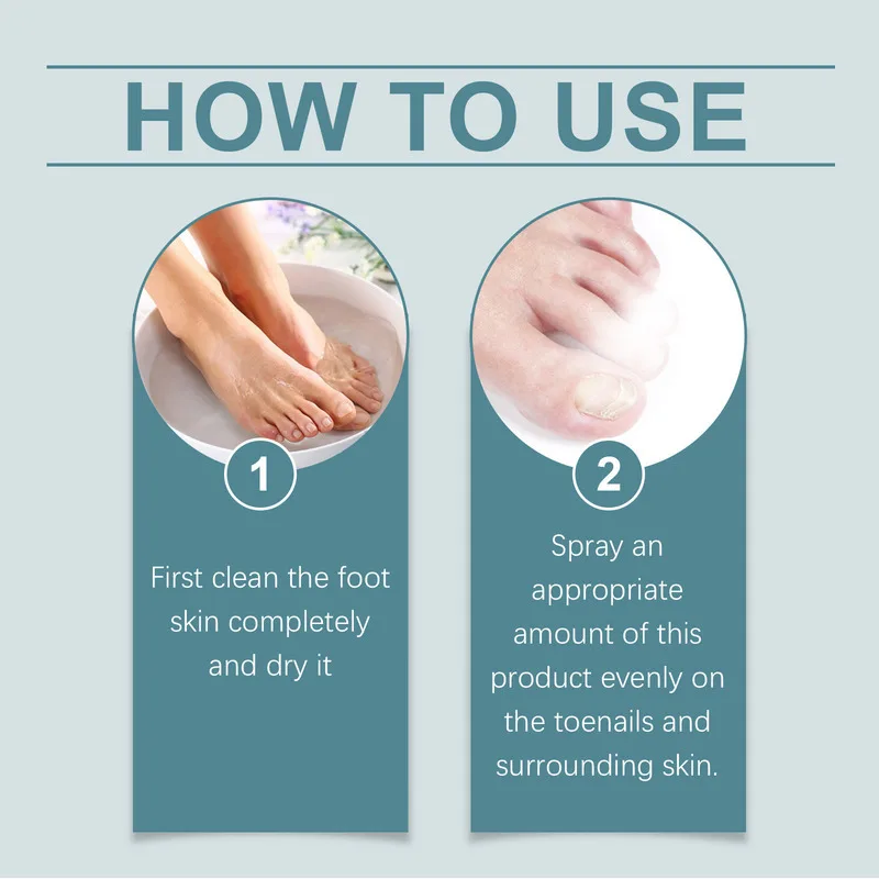 Semprotan Pereda Kuku Tumbuh Ke Dalam Perawatan Jamur Tangan dan Kaki Melembutkan Kuku Tebal Mencerahkan Perawatan Pembersihan Jari Kaki Kesehatan Kuku