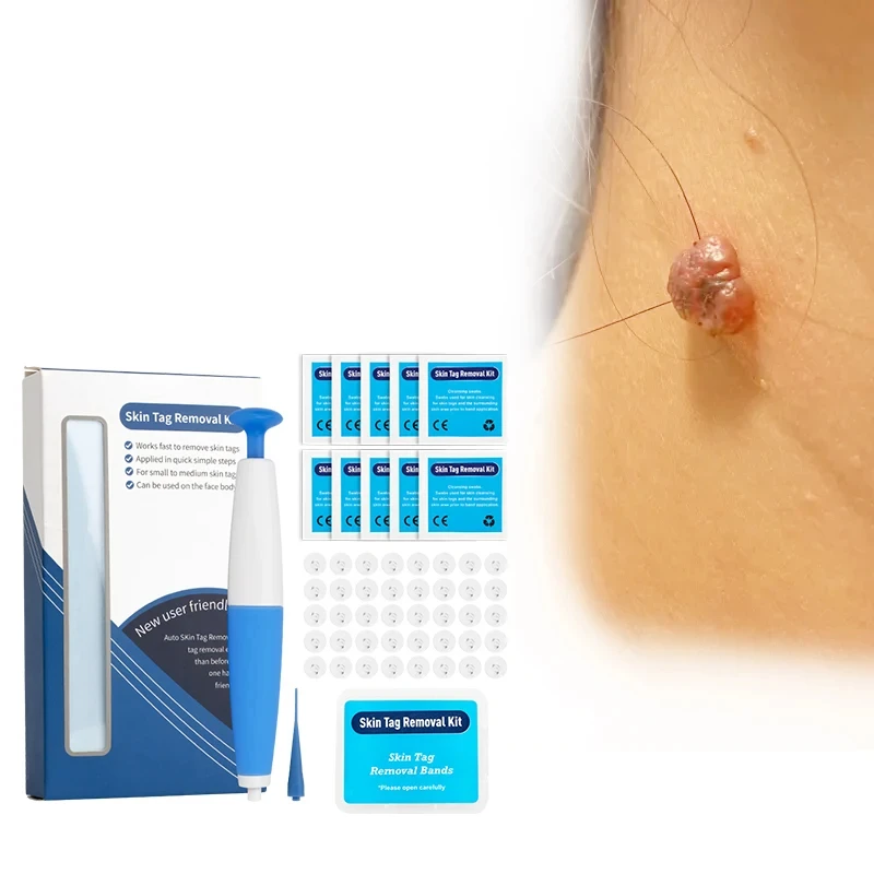 

Wart Removal Pen Skin Tag Removal Tool Kit Wart Cornucopia Treatment Wart Cornucopia Therapy Tool Skin Tag Treatment Tool V