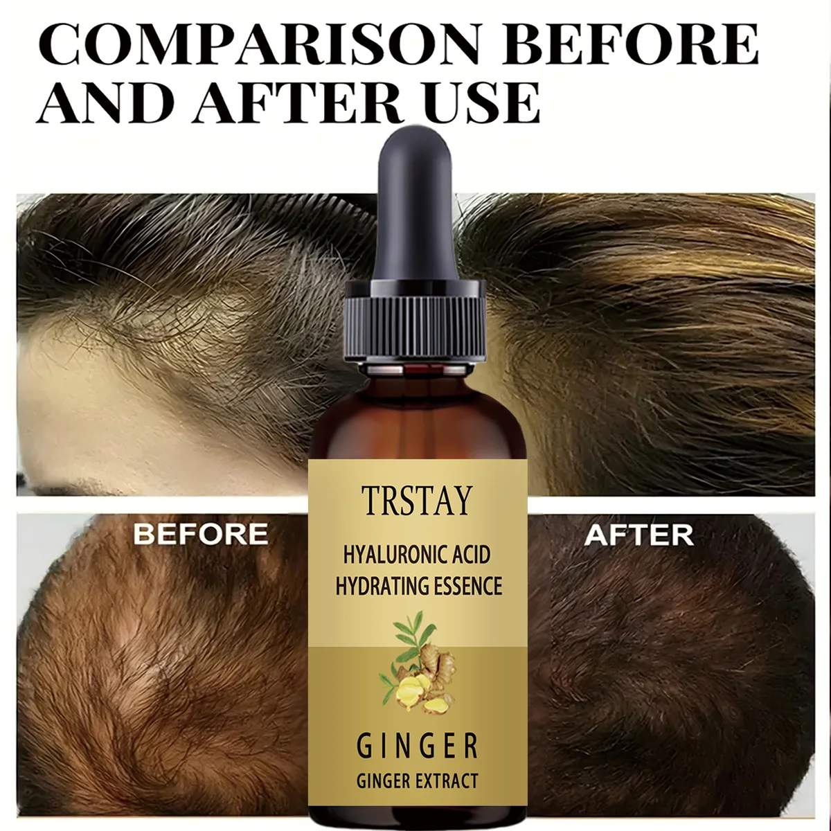 Hair Growth Serum Anti Preventing Hair Loss Alopecia Liquid Damaged Hair Repair Growing Faster - view 2