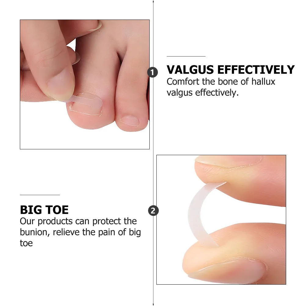 

30Pcs Toenail Correction Stickers Flexible Orthopaedic Patch for Ingrown Toenail Relief Bunion Protection No Glue Pedicure Tool
