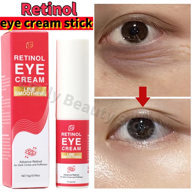 

Retinol Eye Cream Anti-wrinkle Puffiness Eye Bag Remove Lightening Dark Circles Instant Eye Repair Serum Stick Firming Eyes Care