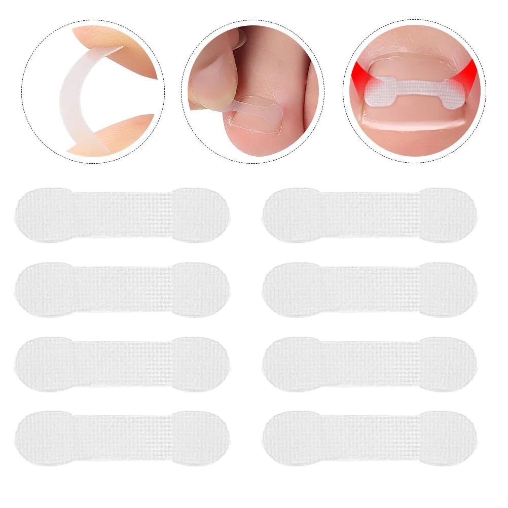 30 Uds pegatinas correctoras de uñas de los pies almohadillas ortopédicas para aliviar el juanete para el dedo gordo Hallux Valgus herramienta para el cuidado de los pies parche de tira para uñas de los pies