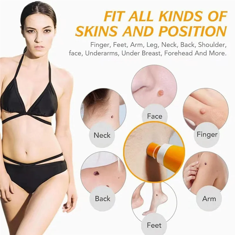 A01V-Auto Skin Tag Removal Kit Painless Mole Wart Skin Dot Corn Treatments Body Facial Beauty Tool Pen Band