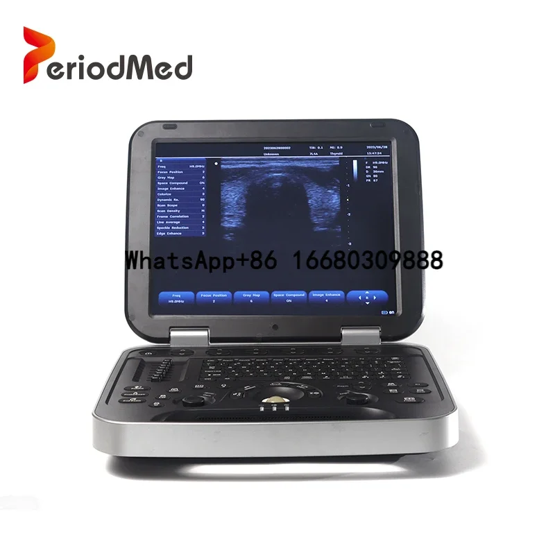 

Periodmed digital echo ecograpghy convex and linear medical medical device ultrasound