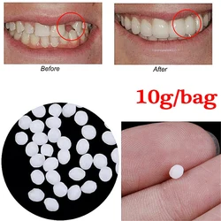 Gránulos de reparación de dientes temporales de resina, huecos de dientes faltantes, relleno de dientes rotos, dentaduras adhesivas moldeables, herramientas de dientes postizos, 50g