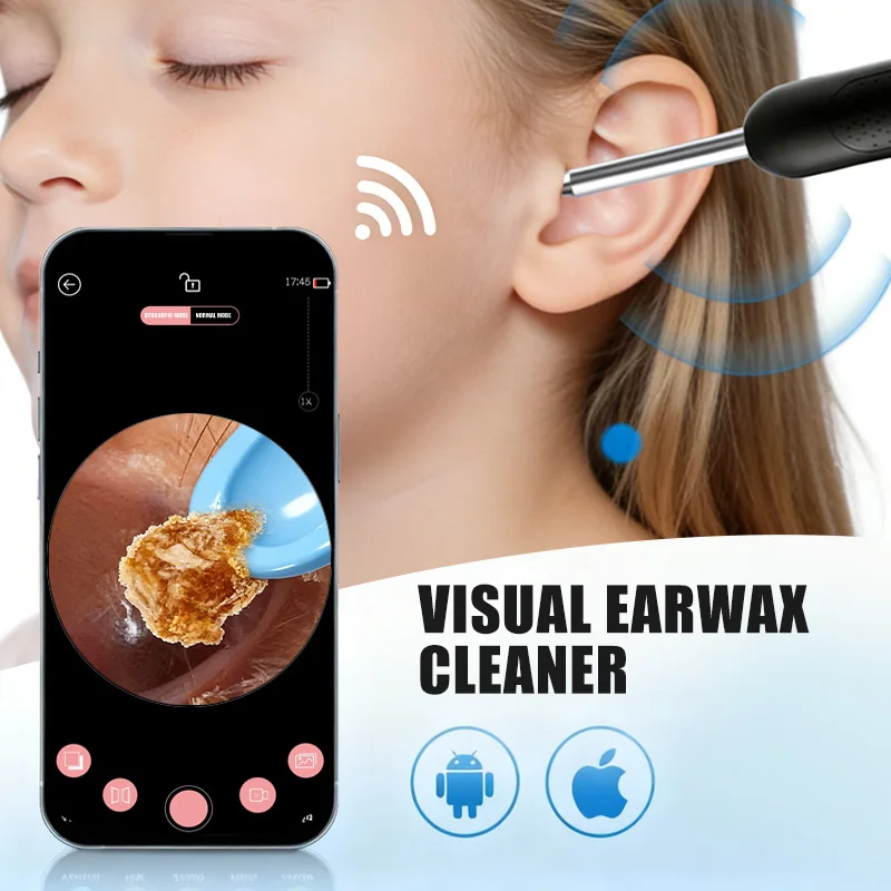 

2025 Новое обновление Wi-Fi для удаления ушной серы, эндоскоп для чистки ушей, отоскоп с камерой, горячая распродажа, общие продукты