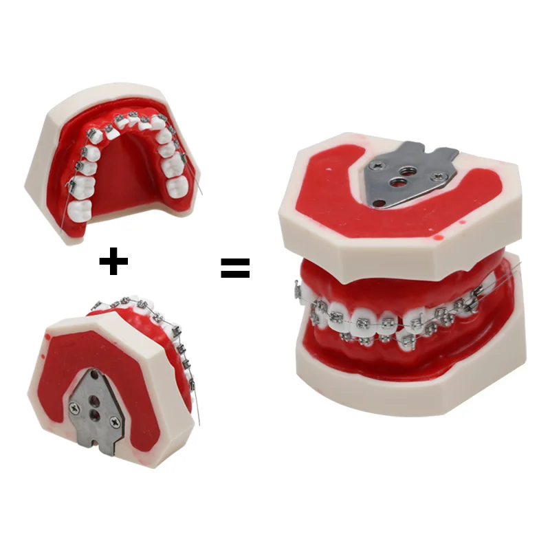 

GREATLH Dental Orthodontic Model for Patient Communication Dentist Study Model Dental Materials