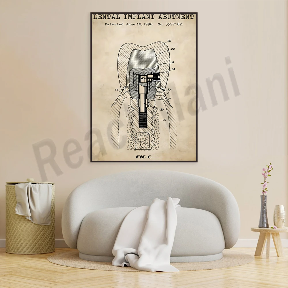 Dentist poster dental implant abutment dental clinic dentist tooth anatomy mural wall art picture decoration