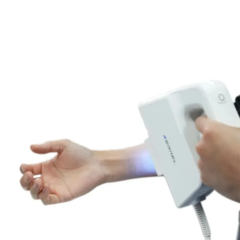 Factory Price Handheld Excimer -price Excimer Equipment in China Portable Excimer 308nm