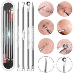 Acne Removal Needles 1/4PCS Stainless Steel Pimple Blemish Blackhead Remove Spoons Face Skin Care Tools Facial Pore Cleaner