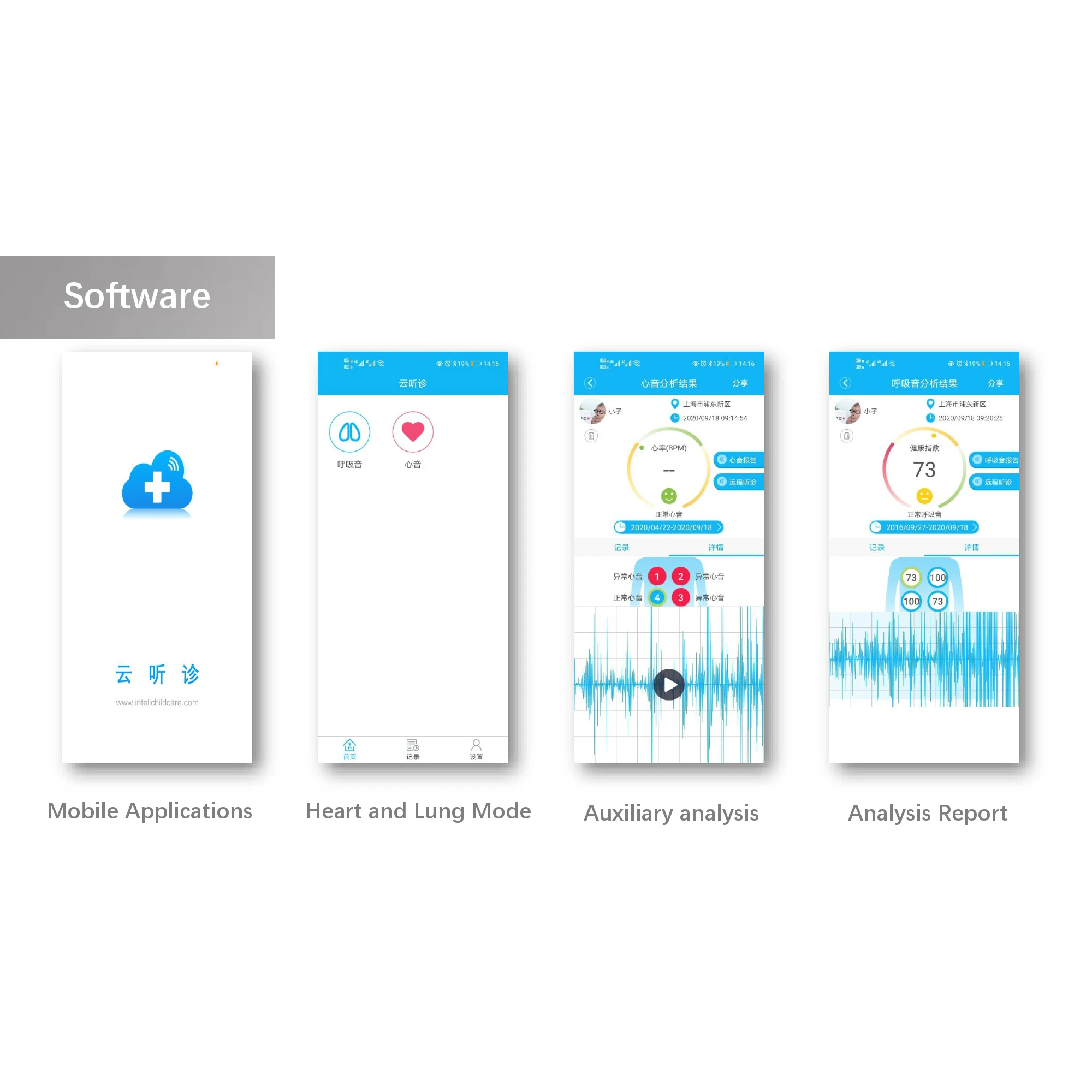 Medical Bluetooth Stethoscope Cardiopulmonary Recording Stethoscope 60 Times Amplify Sound Stethoscope Doctors Nurse Health Care