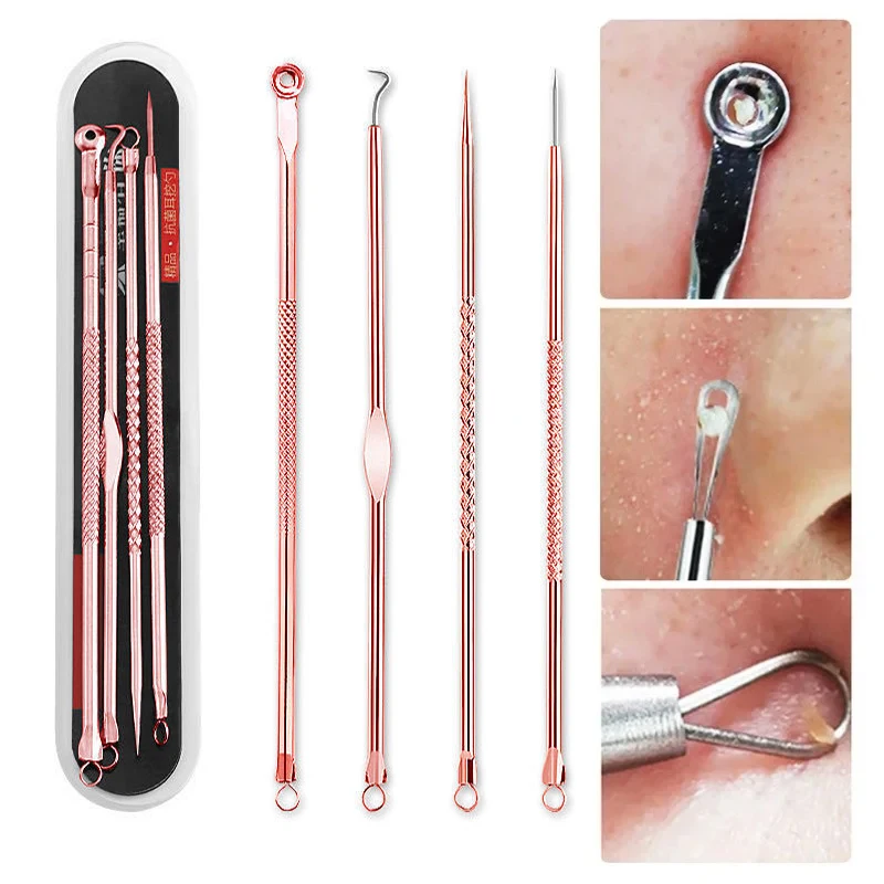 4 ピース/セットにきび除去針ステンレス鋼フェイスクリーンケアツール除去白ニキビにきびにきび傷黒点スポット