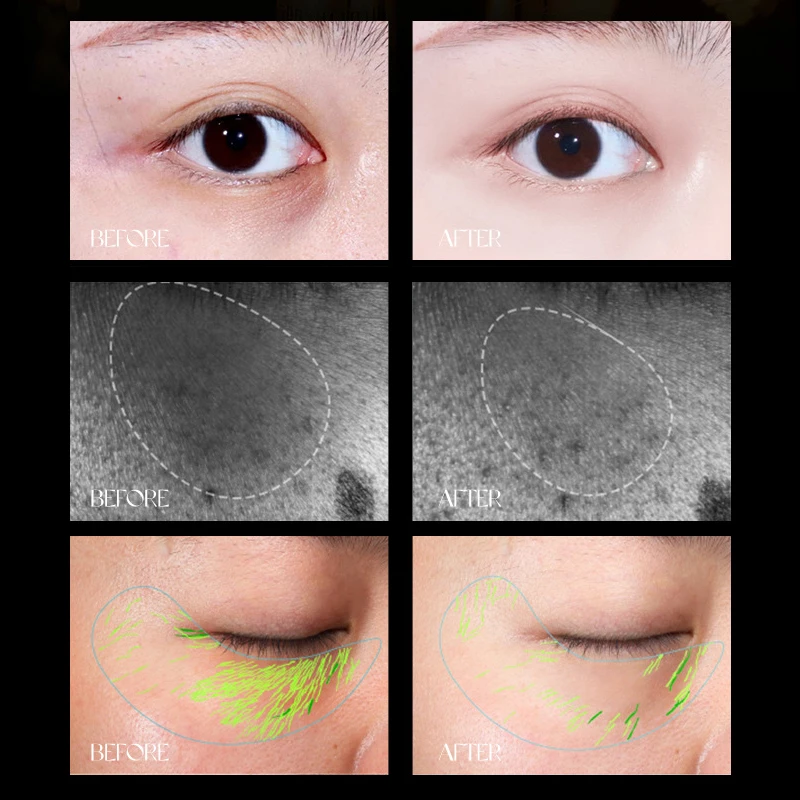 Krem pod oczy przeciwzmarszczkowy Anti-Age usunąć ciemne koła pielęgnacja oczu przed obrzękiem worki nawilżają Augencreme naprawa ujędrniania 30g